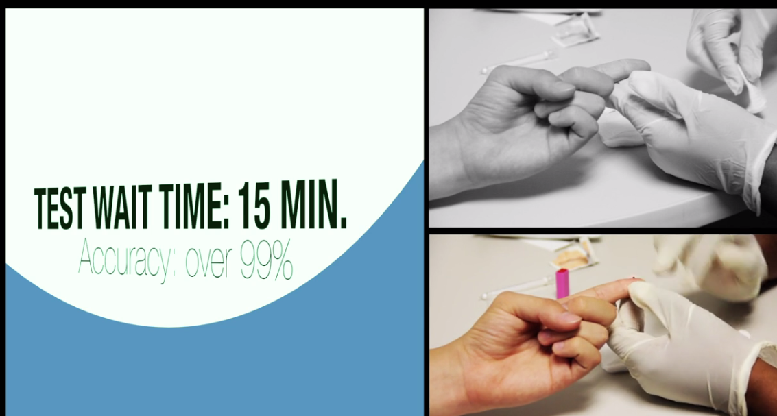 HIV test via finger prick